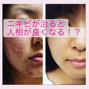 外部（外観）